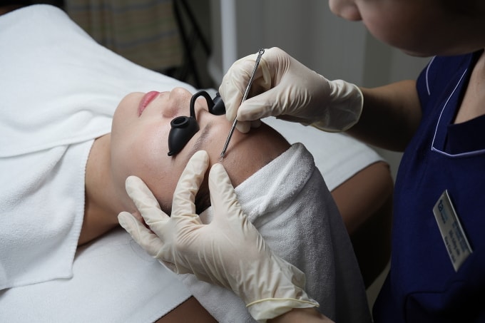 Bác sĩ tiến hành lấy nhân mụn cho một phụ nữ nổi mụn sau peel da. Ảnh minh họa: Bệnh viện Đa khoa Tâm Anh