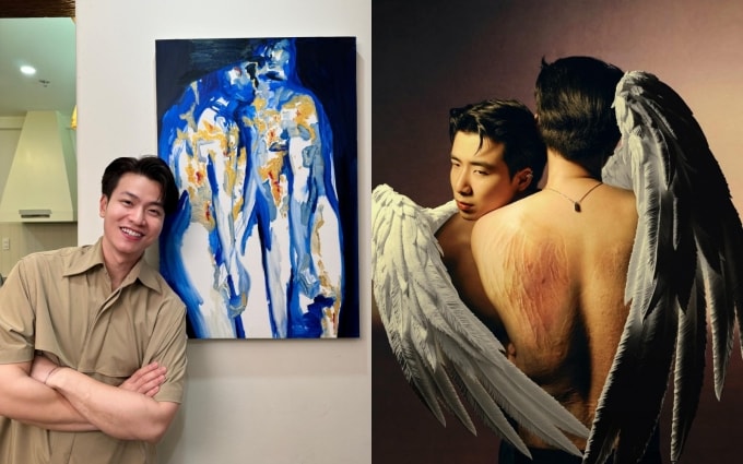 Ninh Anh Bùi bên bức tranh do Tùng Dương vẽ tặng vào dịp sinh nhật hồi tháng 4 (ảnh trái), lấy cảm hứng từ chính vết sẹo trên lưng của anh (phải). Ảnh: Nhân vật cung cấp