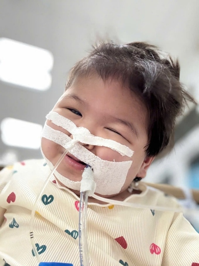 Bé Linh vui cười lúc khỏe. Ảnh: Kim Ny