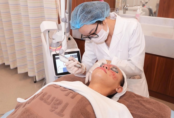 Bác sĩ đang trị nám cho một phụ nữ. Ảnh: Bệnh viện Đa khoa Tâm Anh