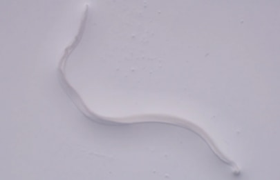 Người phụ nữ đau mắt đi khám, bác sĩ gắp ra thứ "đáng sợ" bên trong- Ảnh 2.