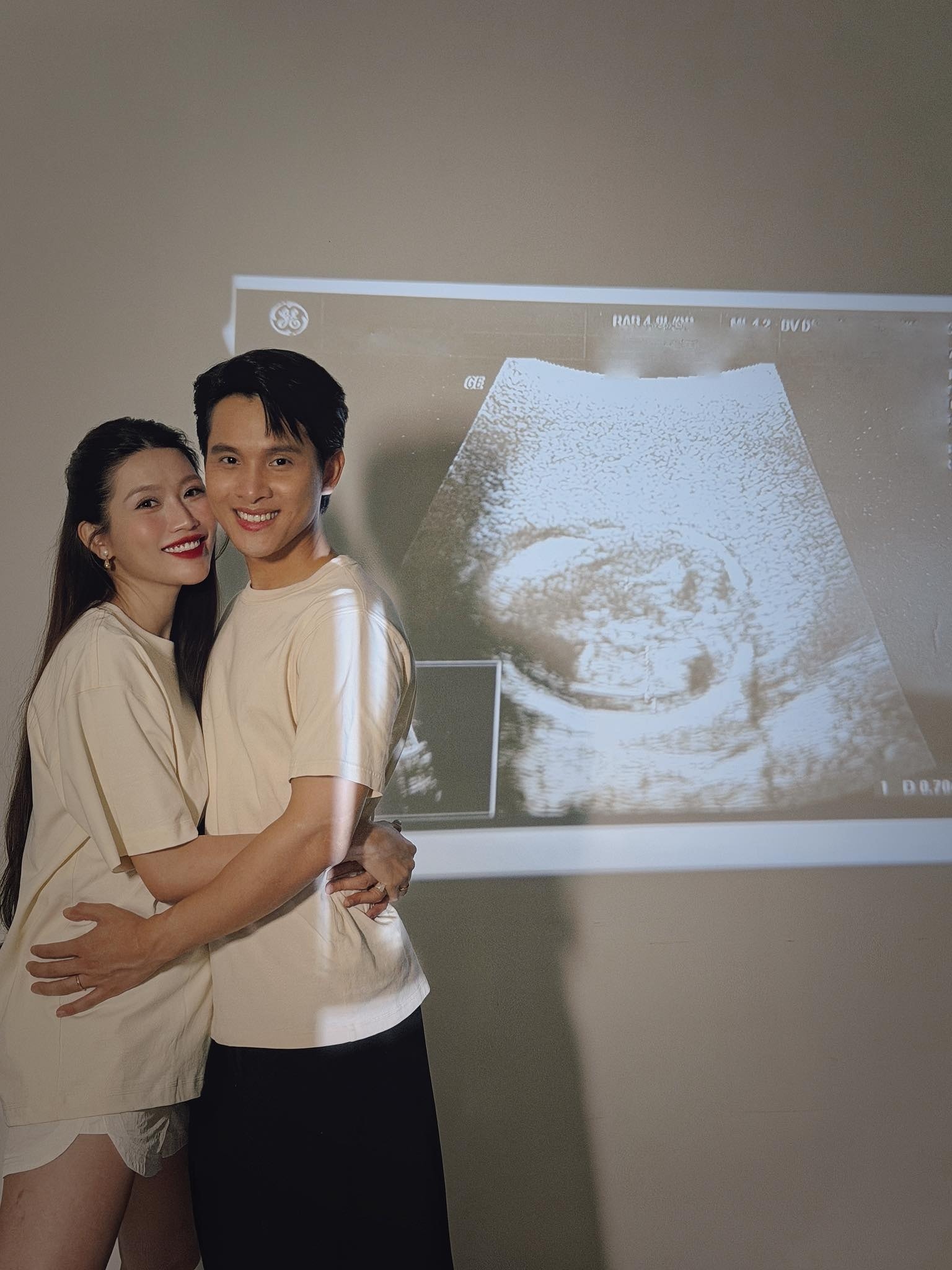 Chế Nguyễn Quỳnh Châu ảnh 1 Che Nguyen Quynh Chau anh 1