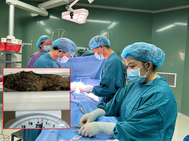 Bé gái 6 tuổi đau bụng dữ dội, bác sĩ gắp ra thứ "đáng sợ" - Ảnh 1.