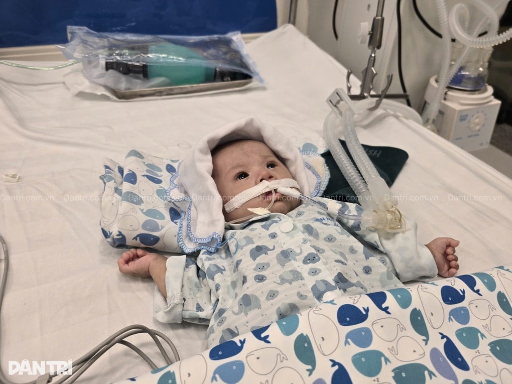 Bé 3 tháng tuổi nguy kịch vì sốc nhiễm khuẩn, cha mẹ nghèo bất lực cầu cứu - 4 Bé 3 tháng tuổi nguy kịch vì sốc nhiễm khuẩn, cha mẹ nghèo bất lực cầu cứu - 4