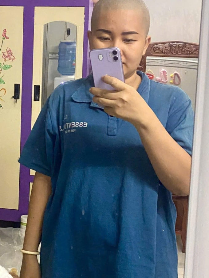 Mắc trầm cảm sau sinh, Huỳnh Như tự cạo trọc đầu. Ảnh: Nhân vật cung cấp