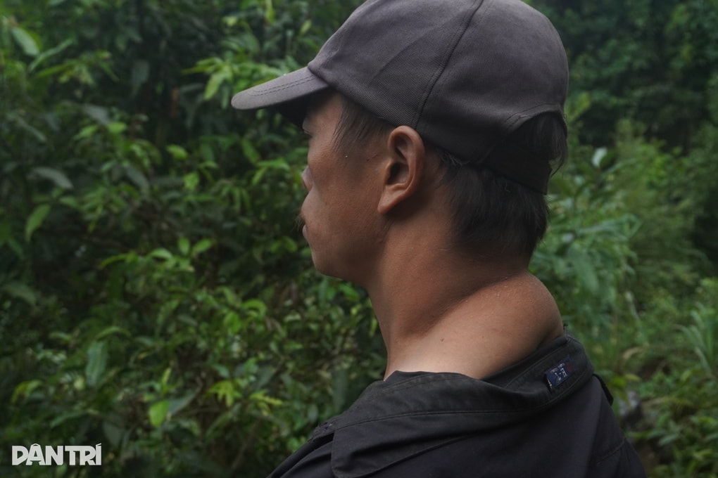 Người đàn ông bị khối u hành hạ và nỗi lo dắt bà lão chạy trốn gió mưa - 3