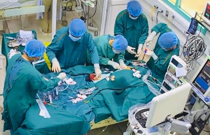 Các bác sĩ Bệnh viện Nhi đồng 2 can thiệp ECMO cho bệnh nhi. Ảnh: Bệnh viện cung cấp