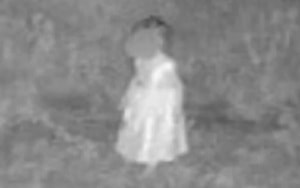 Đang chơi ở sân nhà, bé 8 tuổi bị khỉ tấn công vết thương phức tạp - Ảnh 2.