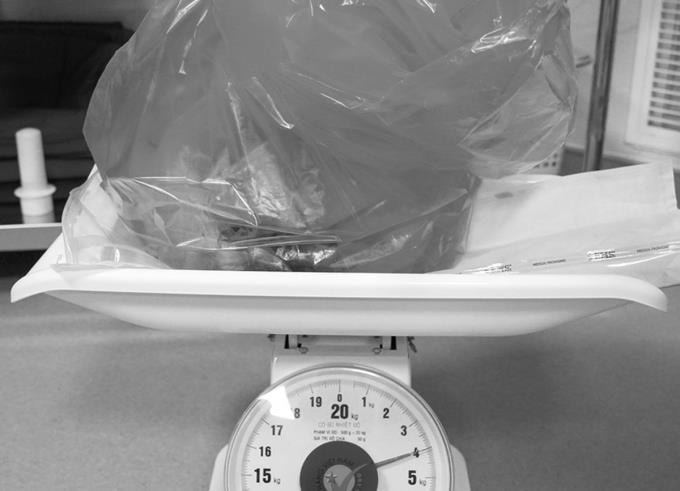 Các bác sĩ phẫu thuật lấy khối u nặng 4 kg trong tử cung người phụ nữ Campuchia. Ảnh: Ngọc Oanh