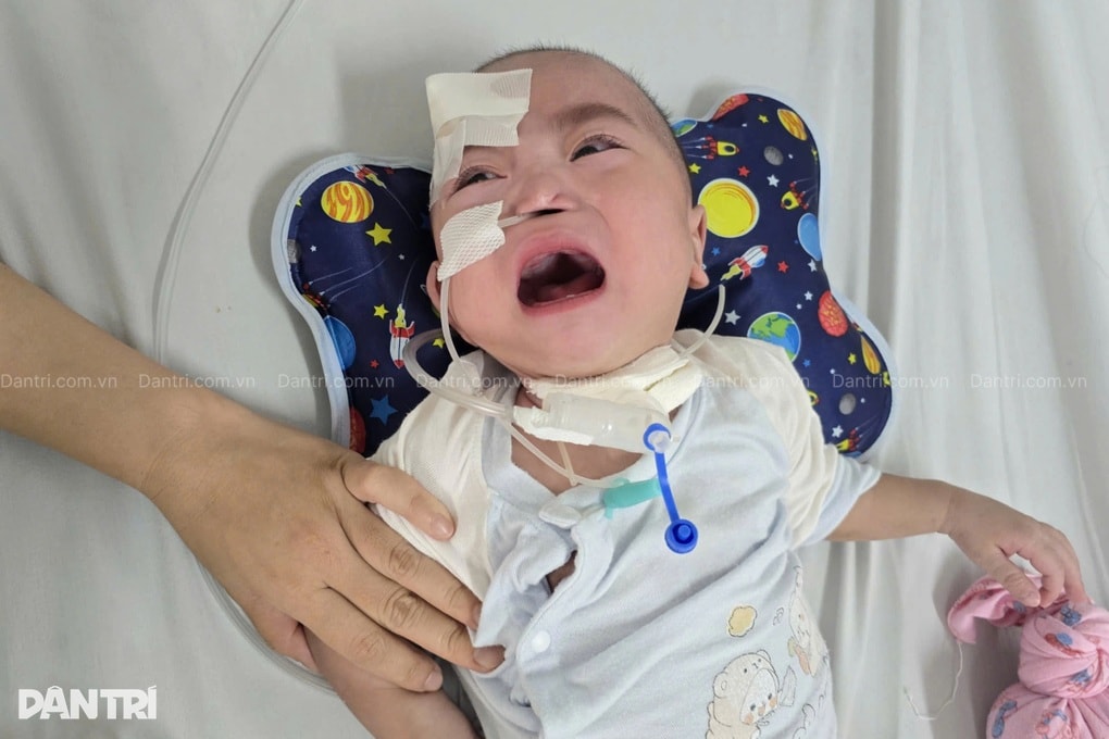 Bé trai sinh non 24 tuần thai, 14 tháng tuổi vẫn chưa thể tự thở - 1