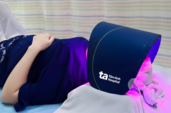 Chị Mỹ được chiếu đèn LED sau laser để hỗ trợ phục hồi, làm dịu da và tăng cường hiệu quả điều trị. Ảnh: Bệnh viện Đa khoa Tâm Anh