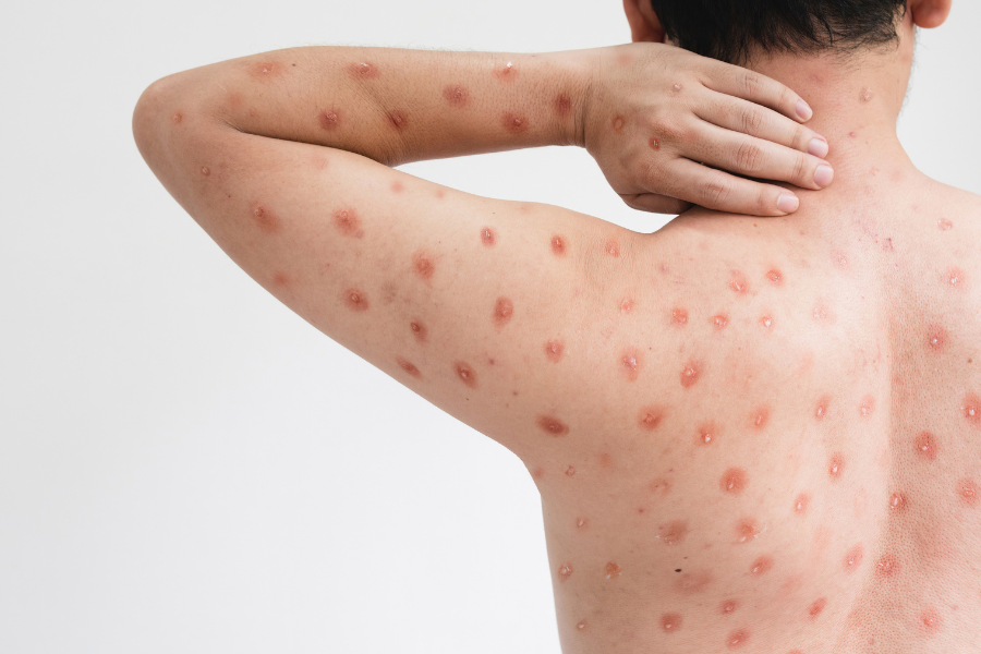 ca đầu mùa khỉ đầu tiên trong năm xuất hiện tại đồng nai