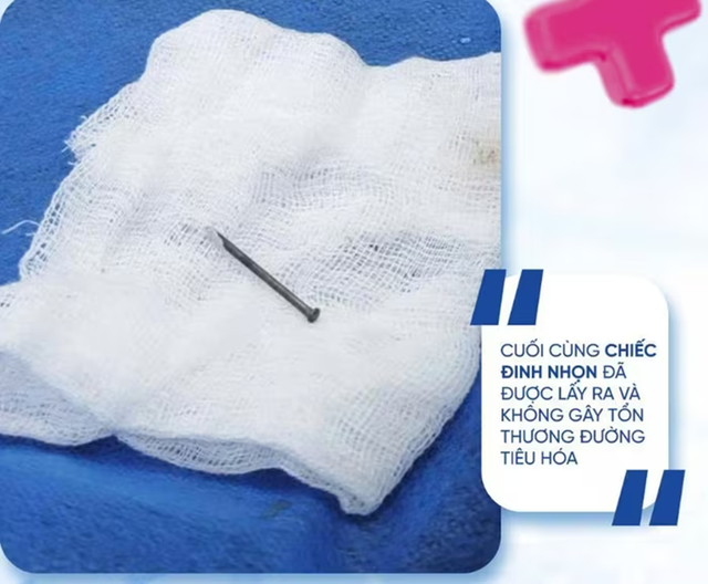 Bé trai 8 nghịch dại, bác sĩ kinh ngạc phát hiện thứ "đáng sợ" bên trong bụng - Ảnh 2.