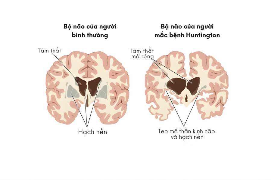 (Prevention Magazine)