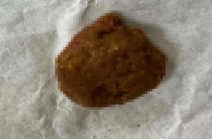 Bé trai 5 tuổi "ôm" ổ khóa nhập viện cấp cứu, bác sĩ phát cảnh báo khẩn - Ảnh 3.