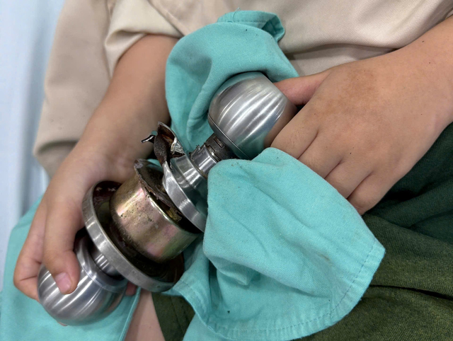 Bé trai 5 tuổi "ôm" ổ khóa nhập viện cấp cứu, bác sĩ phát cảnh báo khẩn - Ảnh 1.