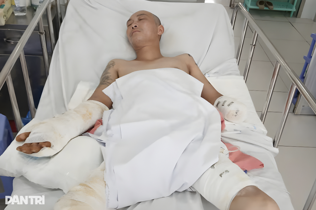 Món quà Giáng sinh nghĩa tình đến với người chồng bị điện giật mất 2 tay - 1 Món quà Giáng sinh nghĩa tình đến với người chồng bị điện giật mất 2 tay - 1