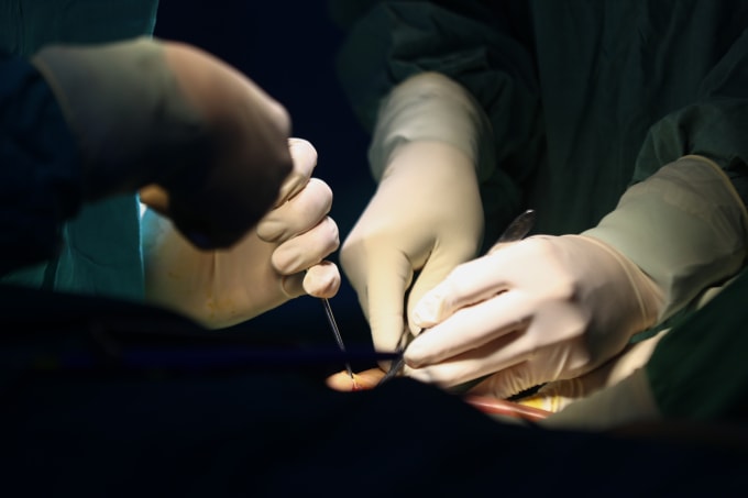 Bác sĩ Bệnh viện Nhi đồng 2 phẫu thuật cho bệnh nhi. Ảnh: Quỳnh Trần