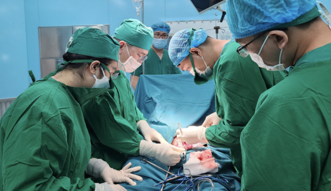 Các bác sĩ phẫu thuật cho bệnh nhân. Ảnh: Bác sĩ cung cấp