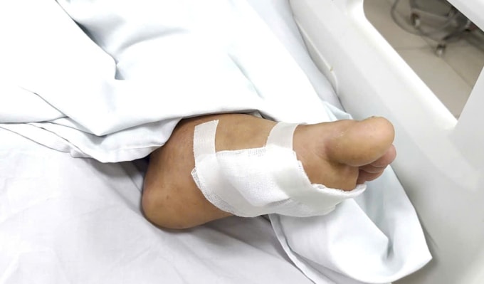 Một bệnh nhân mắc uốn ván điều trị tại viện. Ảnh: Bệnh viện cung cấp