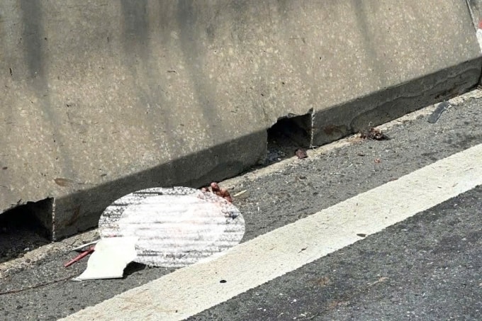 Cánh tay nằm trên đường. Ảnh: Phạm Tư