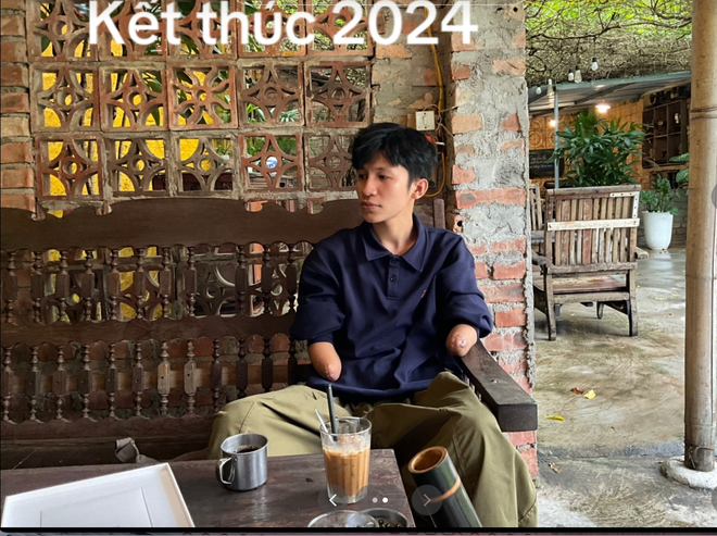 Chàng trai genZ mồ côi, gặp biến cố mất 2 tay, truyền thông điệp tích cực qua từng video- Ảnh 4. Chàng trai genZ mồ côi, gặp biến cố mất 2 tay, truyền thông điệp tích cực qua từng video- Ảnh 4.