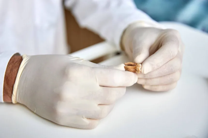 Các nhà nghiên cứu phân tích răng của những binh lính nằm dưới một ngôi mộ tập thể được phát hiện tại Vilnius (Litva) năm 2001. Ảnh: Claudio Centonze/Ủy ban châu Âu