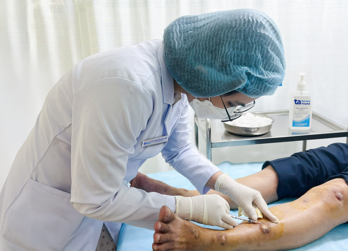 Bác sĩ tiêm hoạt chất triamcinolone để kiểm soát viêm và giảm ngứa cho ông Hậu. Ảnh: Bệnh viện Đa khoa Tâm Anh