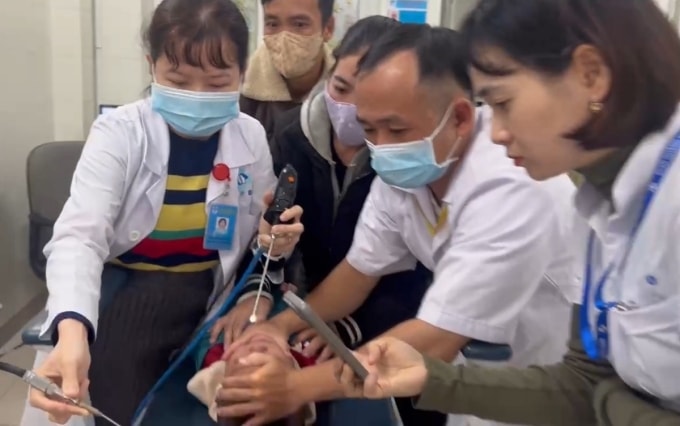 Ê kíp của Bệnh viện Sản Nhi Quảng Ngãi nội soi can thiệp, lấy con vắt trong mũi bệnh nhi. Ảnh: Kim Ny