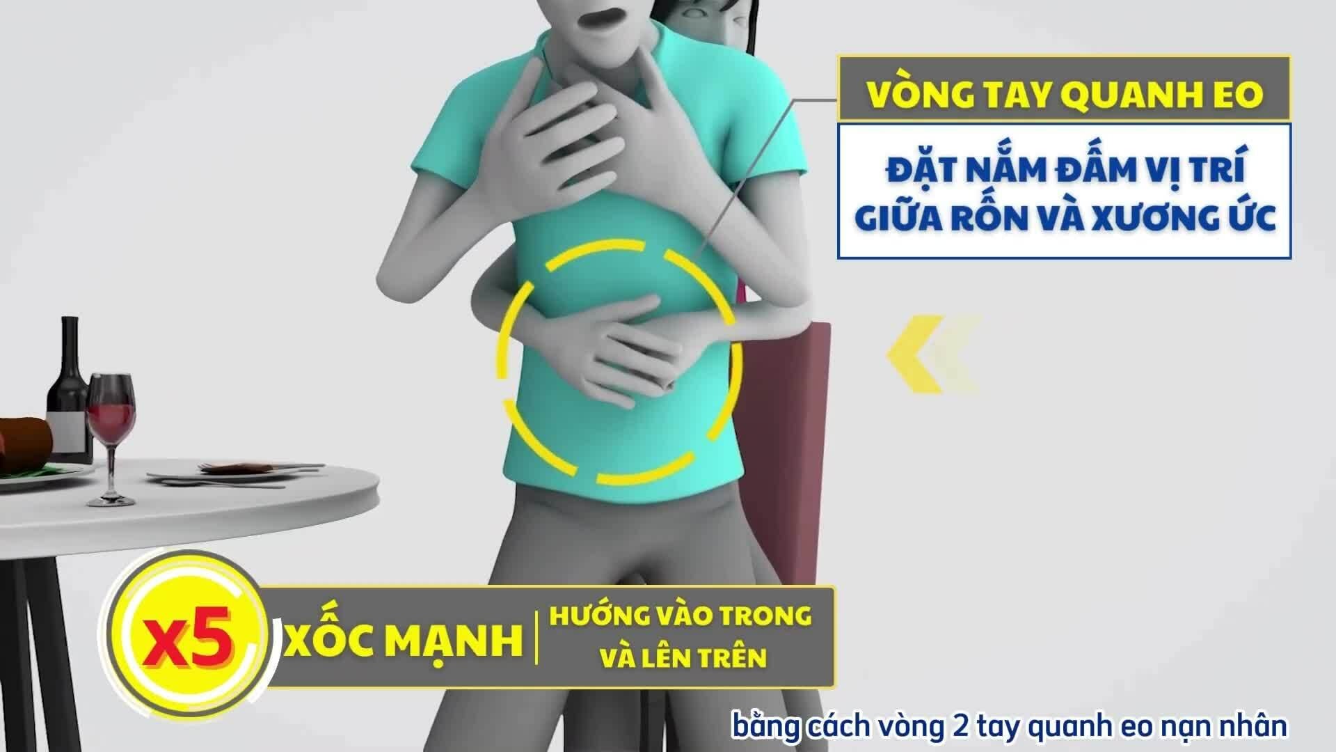 Cách sơ cứu người hóc dị vật