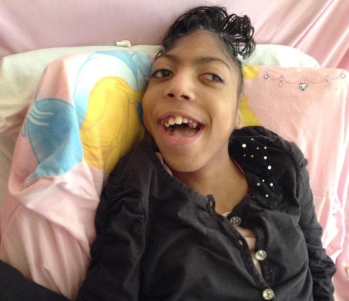 Timesha Beauchamp mắc bệnh bại não, được mẹ chăm sóc tại nhà. Ảnh: OK!