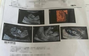 Nữ hộ sinh làm đứt ngón tay bé trai khi cắt dây rốn - Ảnh 2.