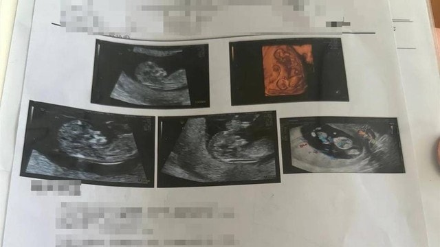 Đi khám thai, người phụ nữ sốc nặng sau khi siêu âm - Ảnh 1.