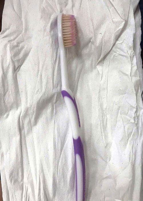 Bàn chải đánh răng được gắp ra khỏi thực quản nữ bệnh nhân. Ảnh: Thái Hà