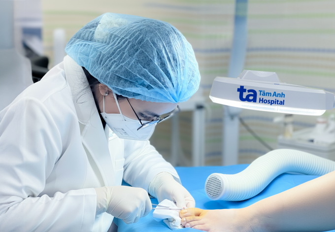 Bác sĩ xử lý ổ viêm, phần móng quặp cho chị Thúy. Ảnh: Bệnh viện Đa khoa Tâm Anh