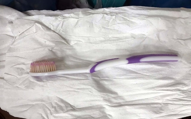 Nuốt nhầm bàn chải đánh răng, người phụ nữ nhập viện cấp cứu trong đêm - Ảnh 1.