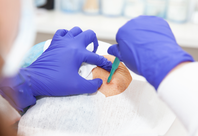 Ảnh minh họa: Clikodoc