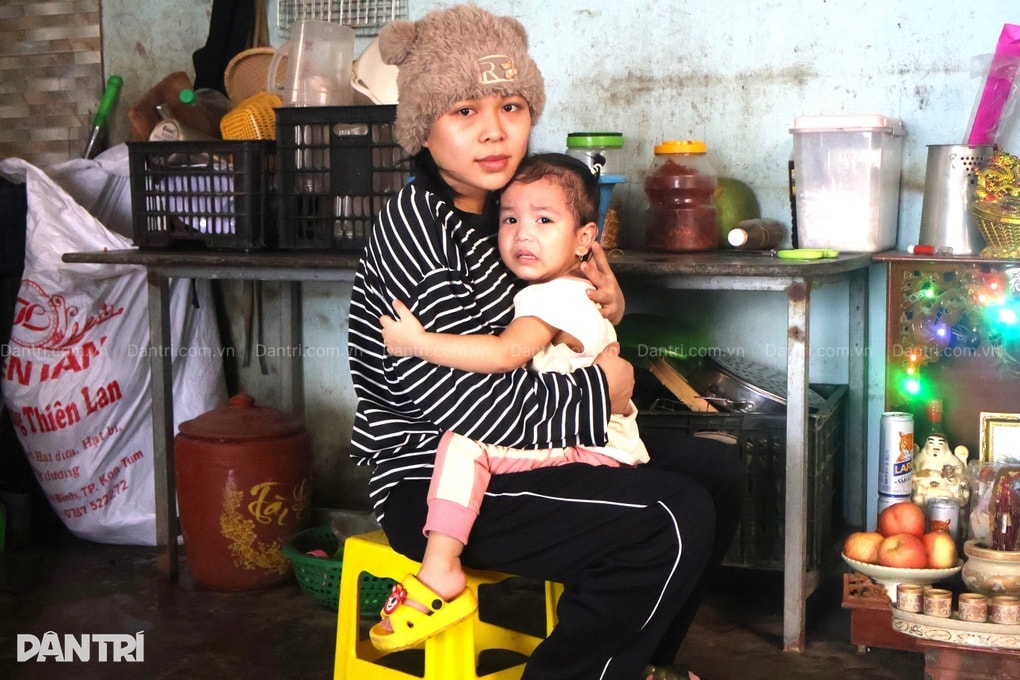 Bé 2 tuổi héo hon từng ngày vì bệnh, cha mẹ nghèo không tiền lo cho con - 2