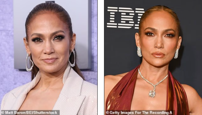 Theo chuyên gia trang điểm, lạm dụng kem che khuyết điểm có thể đọng lại vào các nếp nhăn nhỏ dưới mắt. Ảnh minh họa: Shutterstock/GT