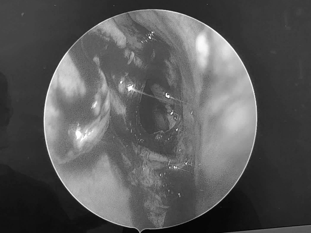 Đi khám, người đàn ông sốc nặng khi bác sĩ thấy thứ "đáng sợ" trong mũi mình- Ảnh 1.