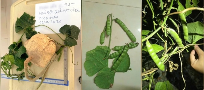 Hạt củ đậu mà các bệnh nhân ăn. Ảnh: Bệnh viện cung cấp