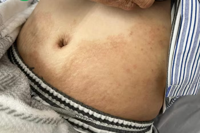 Thường xuyên ăn món "vạn người mê", cô gái trẻ sốc khi biết nhiễm 4 loại ký sinh trùng - Ảnh 1.