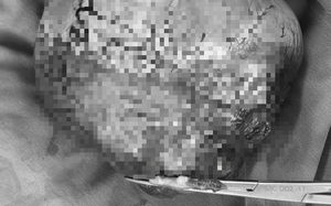 Bộ Y tế yêu cầu kiểm tra khẩn bếp ăn nhà hàng tiệc cưới sau phản ánh mất vệ sinh - Ảnh 3.