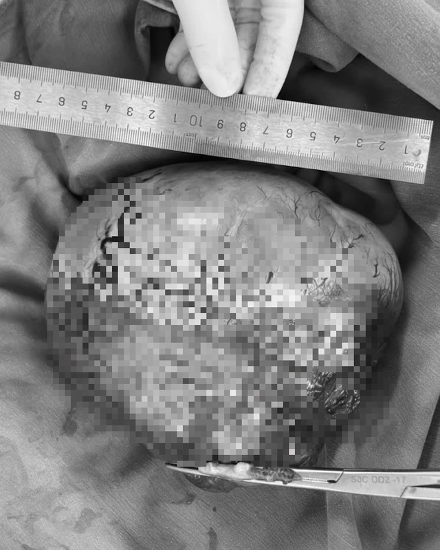 Đi siêu âm, người đàn ông sốc nặng khi thấy vật thể "lạ" khổng lồ trong ổ bụng - Ảnh 1.