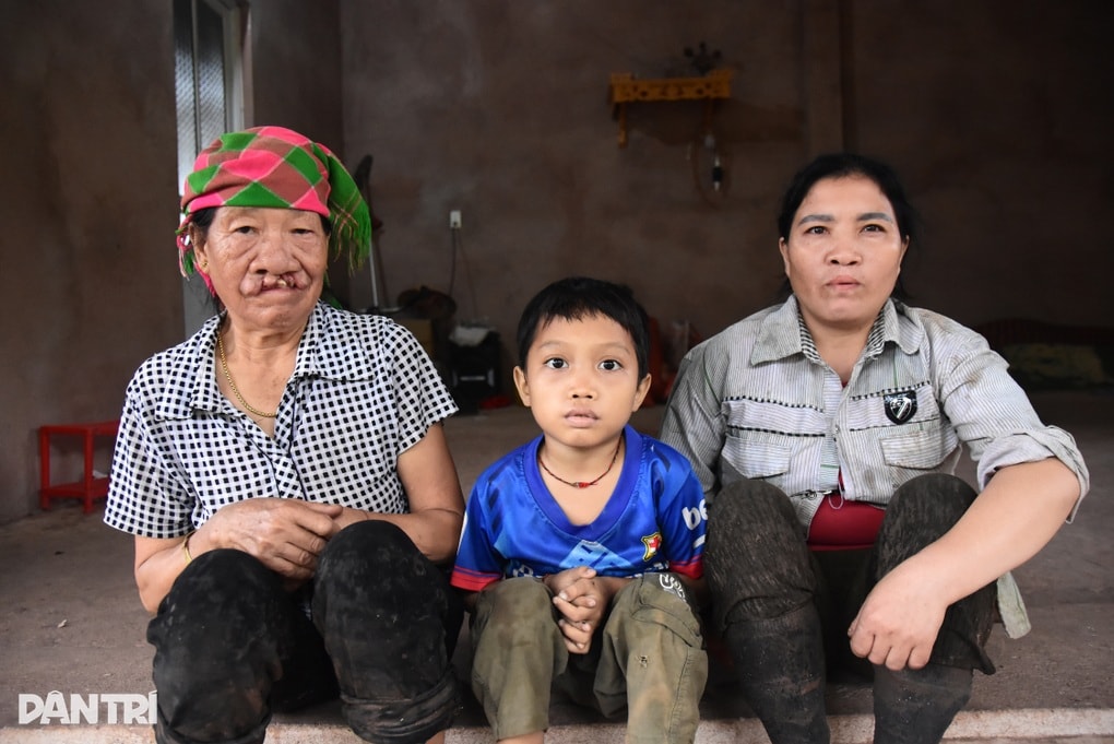 Gia đình nghèo kiệt quệ sau 9 năm giành giật sự sống cho con mắc bệnh hiểm - 2