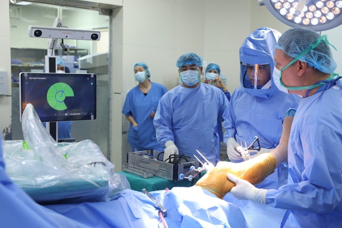 Bác sĩ Thành (đội mũ trùm) và kíp mổ đang sử dụng Robot CORI phẫu thuật cho bệnh nhân. Ảnh: Bệnh viện cung cấp