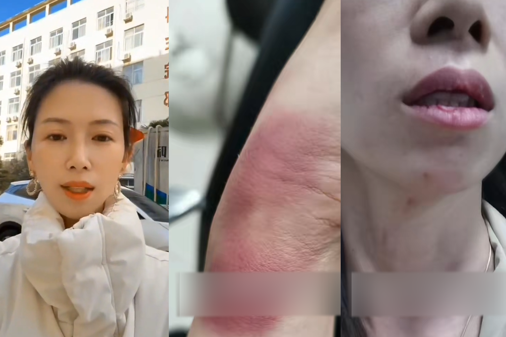 Xin lỗi theo lệnh tòa, vợ kể chuyện chồng ngoại tình gây sốt Trung Quốc - 2