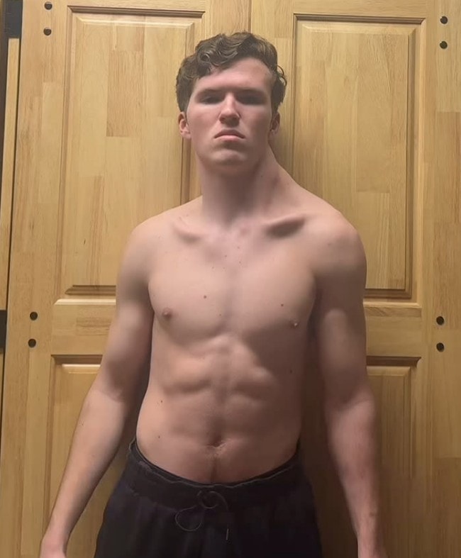 The Crooked Man với một bên vai gồ lên sau thời gian dài chỉ tập luyện một bên. Ảnh: thecrookedman10