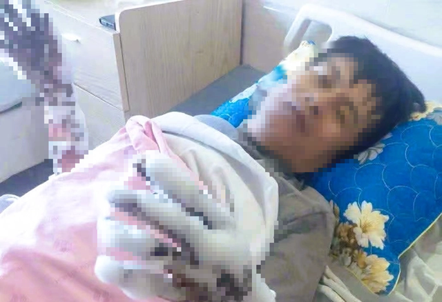 Bị phóng điện, người đàn ông bị bỏng nặng - Ảnh 1.