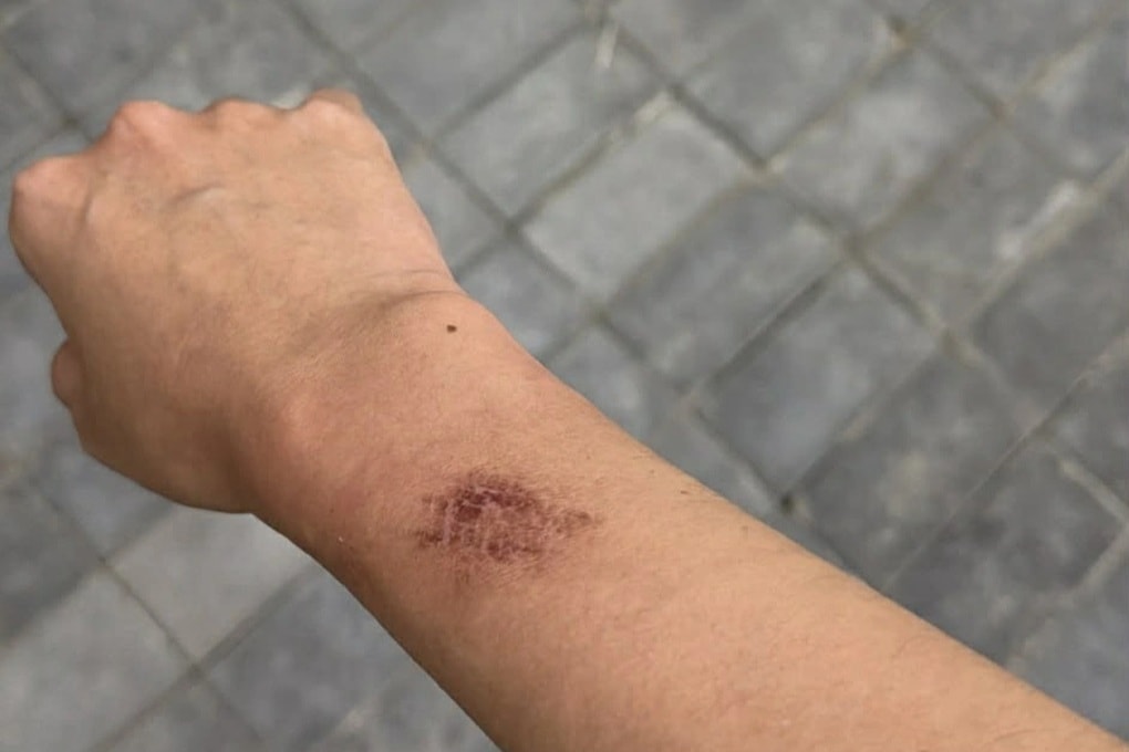 Công ty thưởng văn nghệ 20 triệu đồng, nhân viên tập luyện đến chấn thương - 3